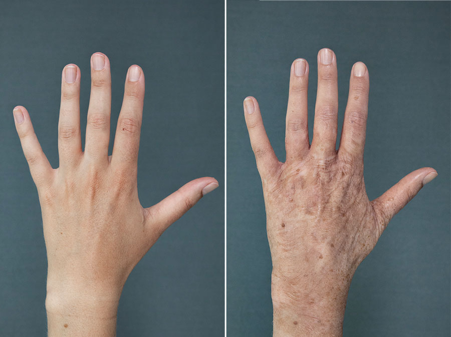 OAHands_LeftBA_900x673px