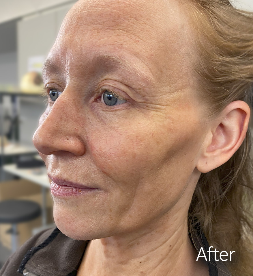 Old-age-complete-applicaiton-3