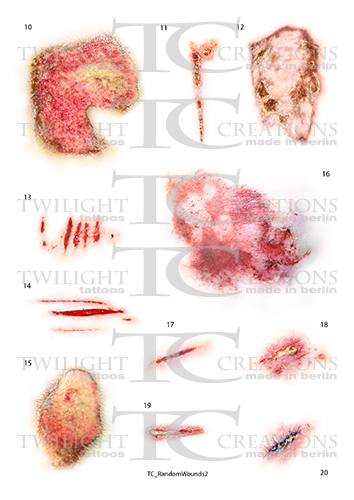 TC_RandomWounds2_preview