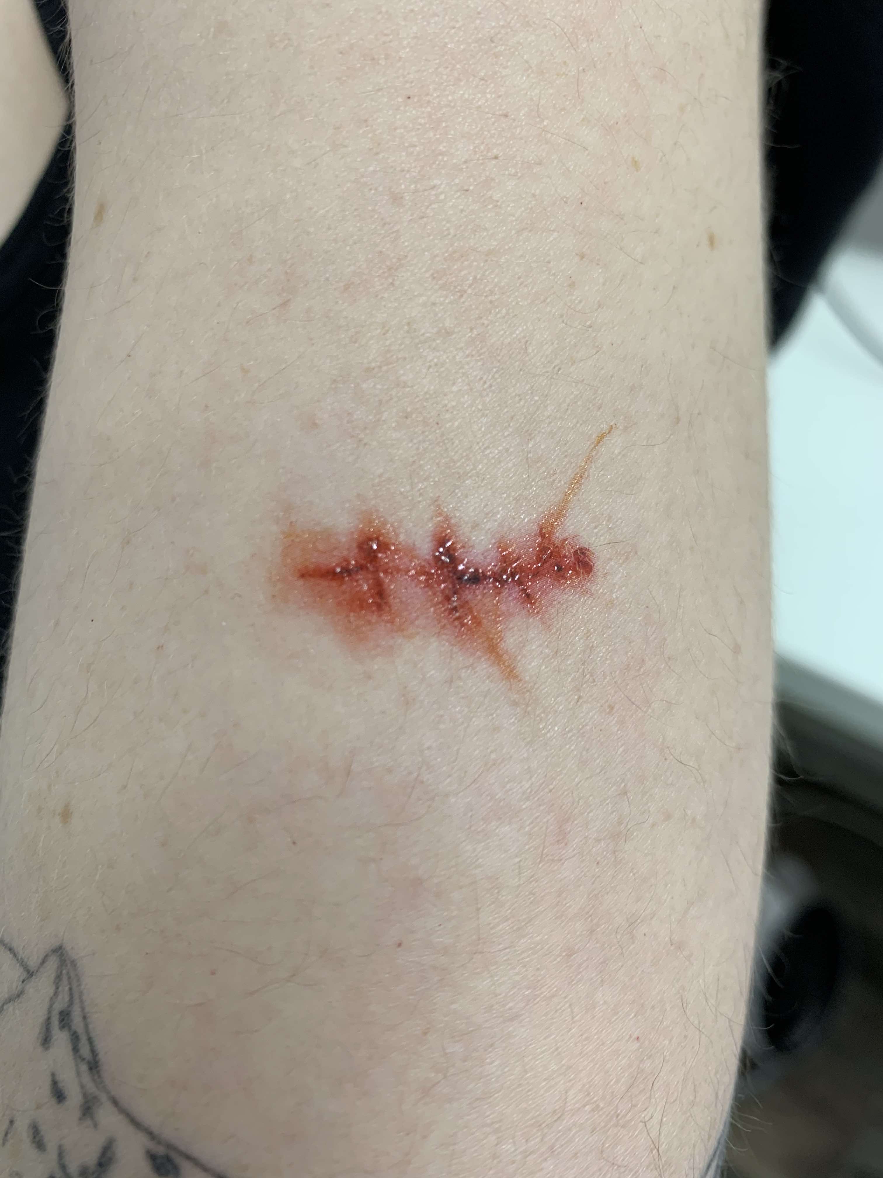 TC_Scarsandsutures-3_appliedlkUsoWzUVk8vn