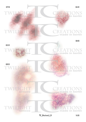 TC_Bruises2_B_preview