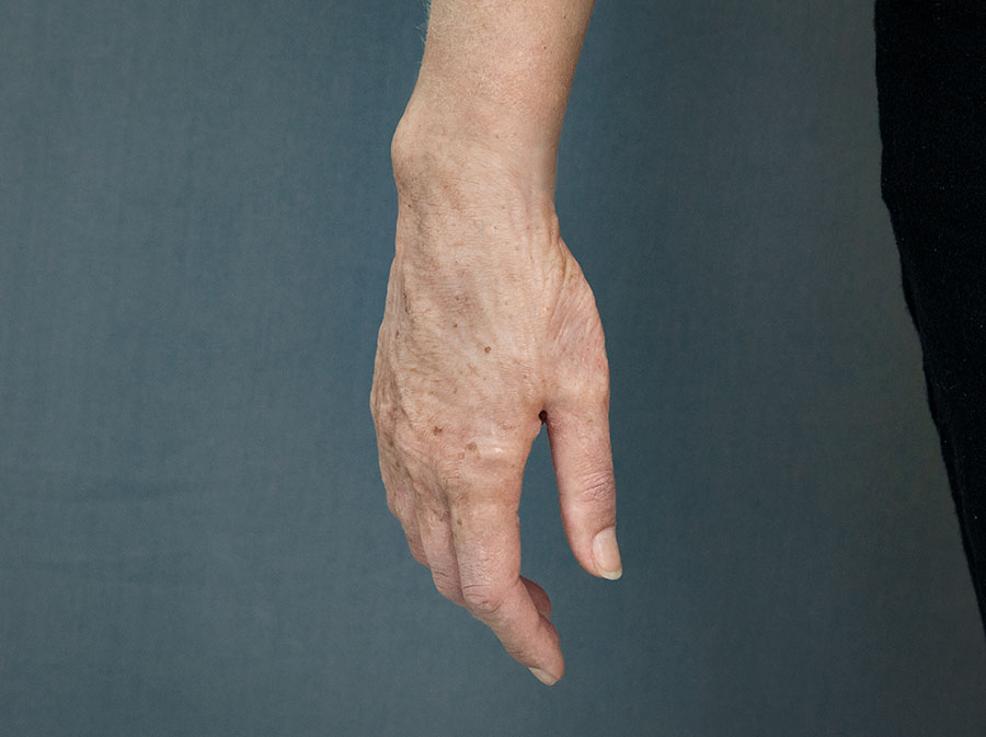 OAHands_rightrelaxed_900x673px