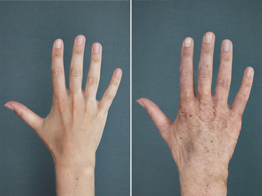 OAHands_rightBA_900x673px