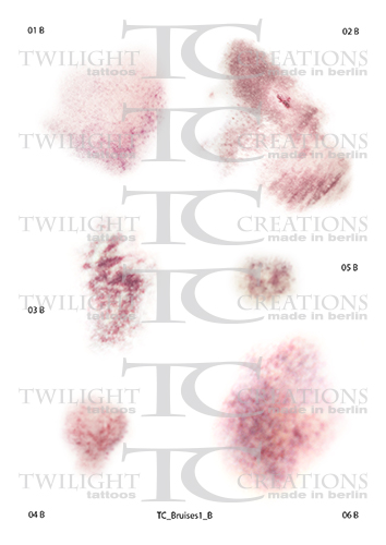 TC_Bruises1_B_preview