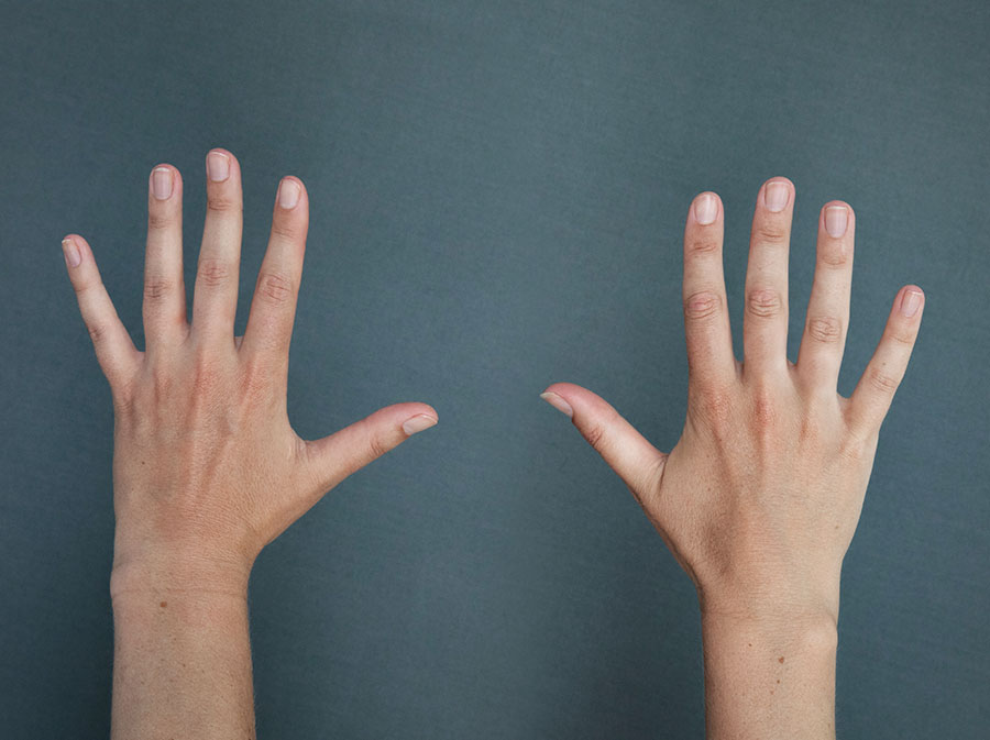 OAHands_before_900x673px