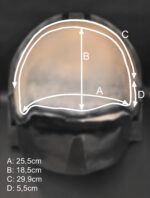 OA10_Halbglatze 1 – Bild 6