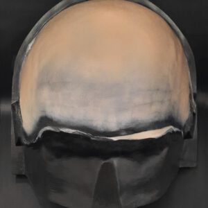 OA10_Halbglatze 1