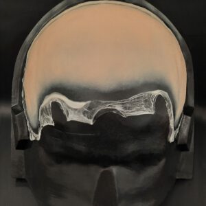OA10_Halbglatze 2