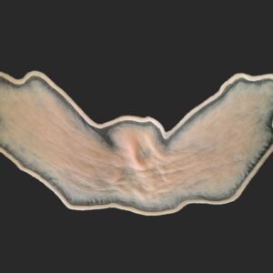OA10_Halsteil