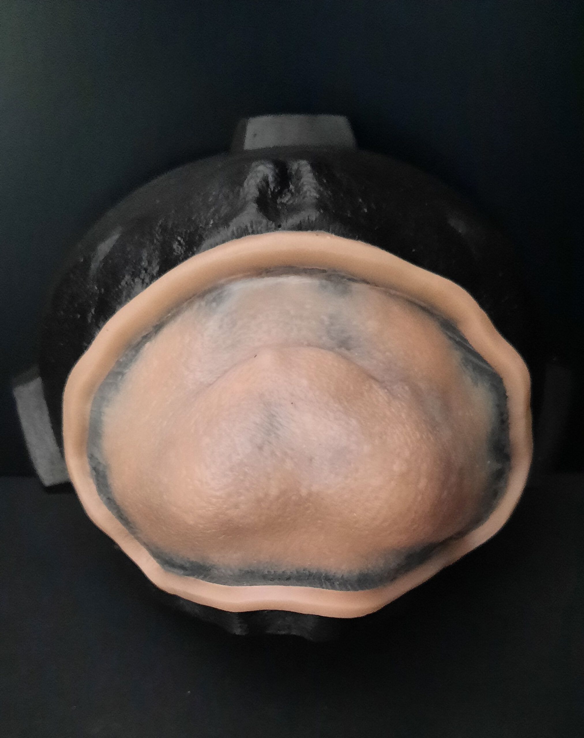 OA14_Chin Front View OA14_Kinn – Bild 1