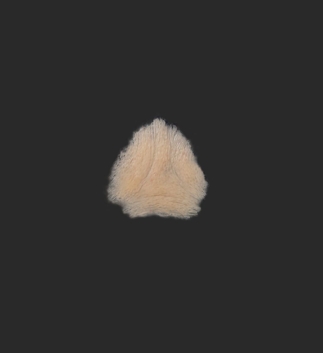 OA2_Frown Line OA2_Zornesfalte – Bild 1