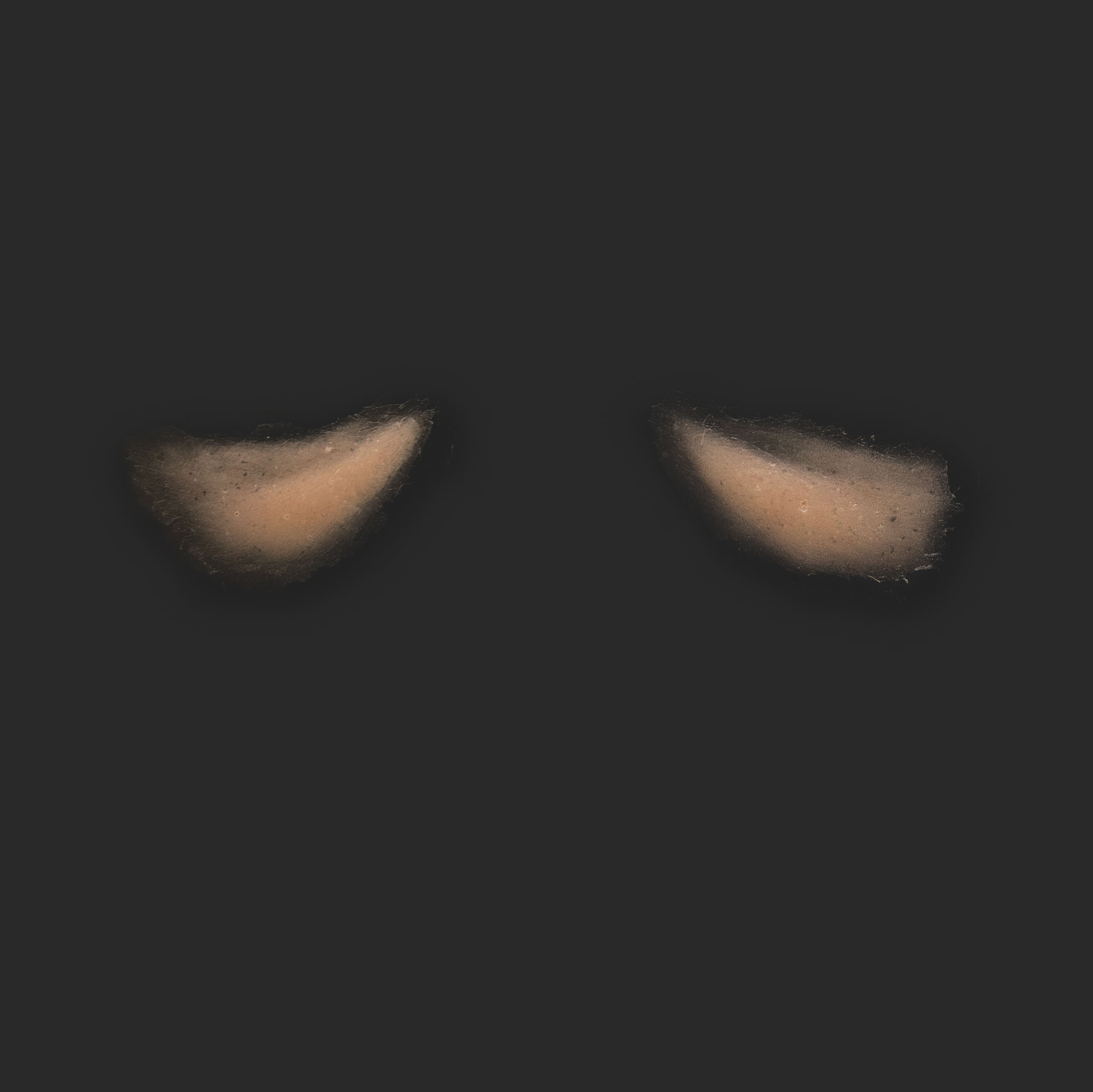 OA3_Pair of Eyebags OA3_Tränensäcke L+R – Bild 1