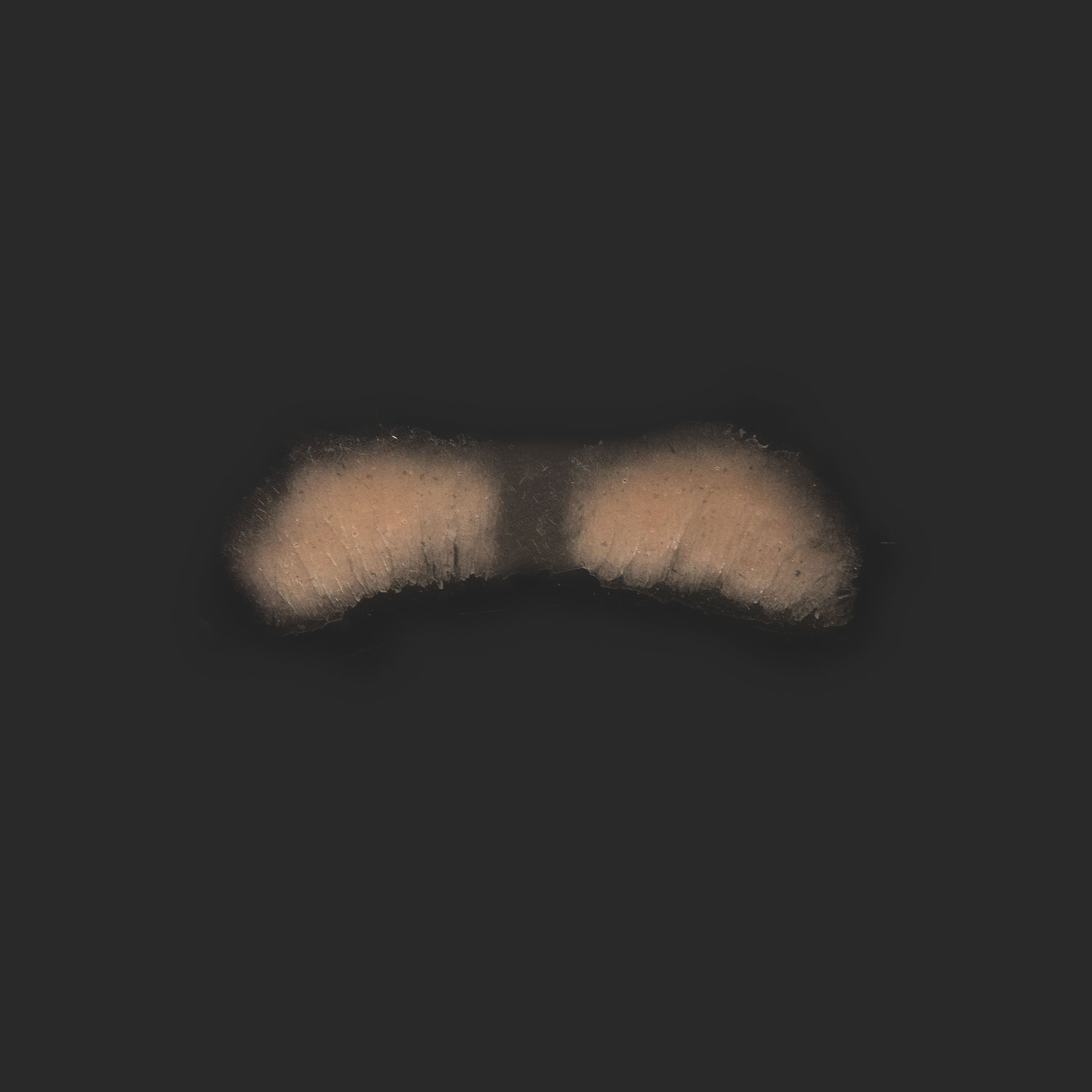 OA3_Upper Lip OA3_Oberlippe – Bild 1