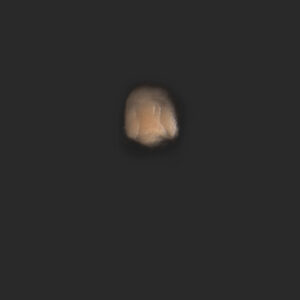 OA4_Zornesfalte