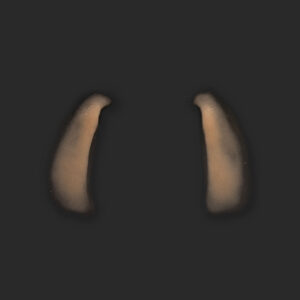 OA4_Nasolabialfalten L+R