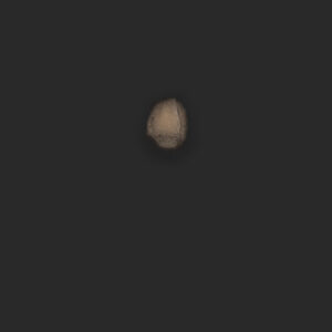 OA5_Zornesfalte