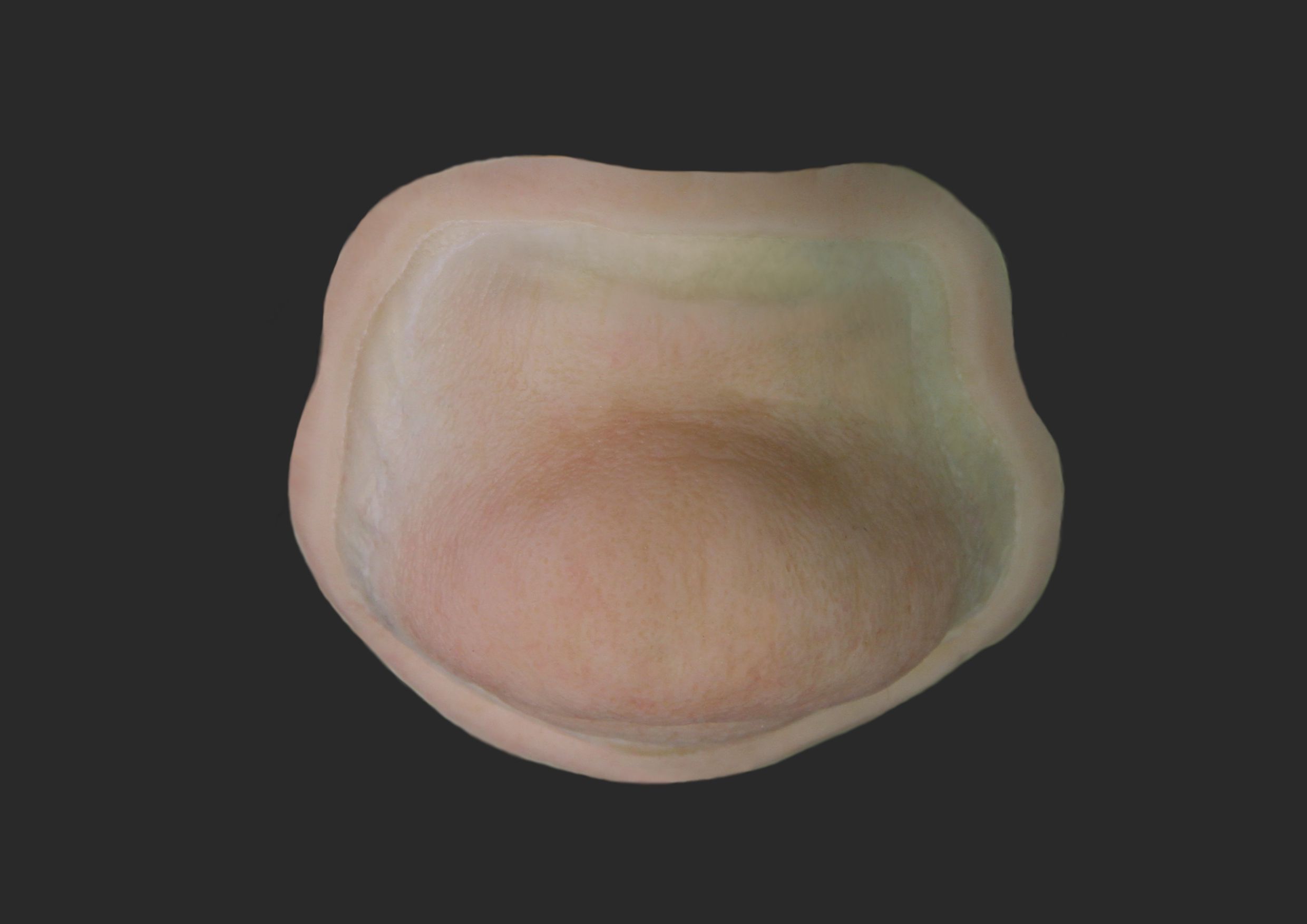 OA9_Chin OA9_Kinn – Bild 1