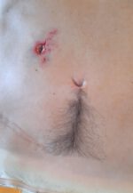 Bauch-Prosthetic mit Einschussloch – Bild 4