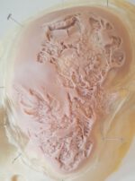 Gesichts-Prosthetic: Multitrauma 1 – Bild 2