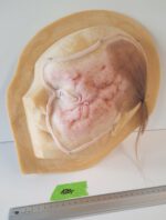 Gesichts-Prosthetic: Starke Vernarbung – Bild 2