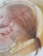 Gesichts-Prosthetic: Starke Vernarbung – Bild 3