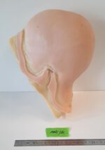 Glatze 1