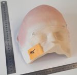 Halbglatze 1 – Bild 3