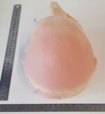 Halbglatze 1 – Bild 4