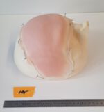 Halbglatze 2 – Bild 3
