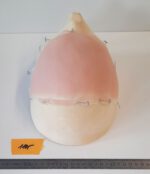 Halbglatze 2 – Bild 4