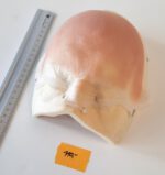 Halbglatze 3 – Bild 2