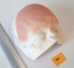 Halbglatze 3 – Bild 3
