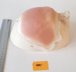 Halbglatze 3 – Bild 4