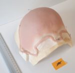 Halbglatze 4 – Bild 2