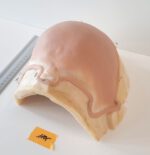 Halbglatze 4 – Bild 3