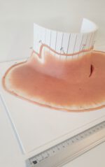 Halsschnitt 3 – Bild 2