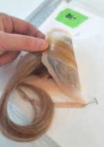 Kopfplatzwunde mit Haar – Bild 3