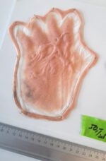Vernarbte Hände S3 – Bild 2
