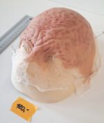 Vernarbte Halbglatze 1 – Bild 3