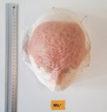 Vernarbte Halbglatze 1 – Bild 4