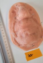 Vernarbte Nase + Lippe + Kinn_2 – Bild 2