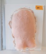 Vernarbter Hinter- und Oberkopf_1