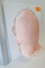Vernarbter Hinter- und Oberkopf_1 – Bild 2