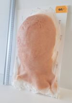 Vernarbter Hinter- und Oberkopf_3 – Bild 2