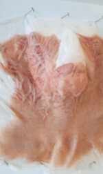 Vernarbtes Gesicht + Hals – Bild 2
