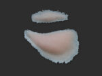 SB6 Geschwollenes Auge (links)