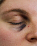 Black Eye B
