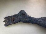 Burned Foot