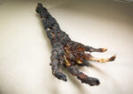Burned Hand