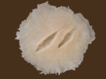 SW6 Stichwunde